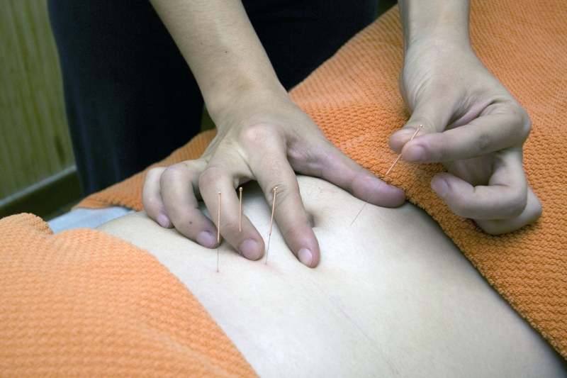 osteopathe-DRAP-min_acupuncture-4175625